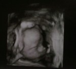 Before we knew Francis as "he"...